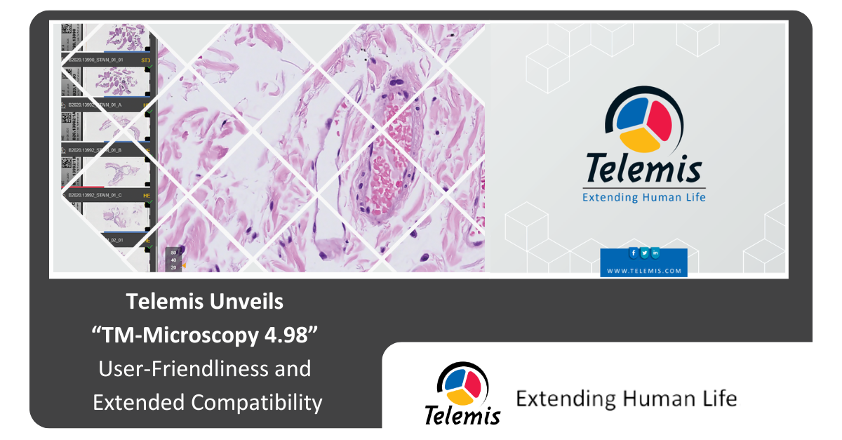 TM-Microscopy 4.98 : Convivialité et compatibilité étendue
