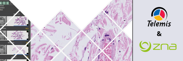 Du microscope à l'écran : Le laboratoire d'anatomie pathologique ZNA passe au numérique