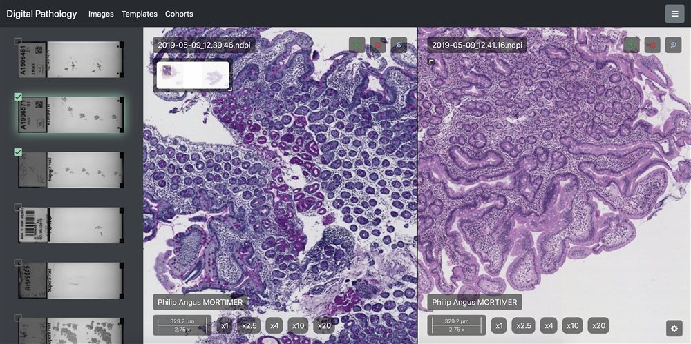 Digital pathology